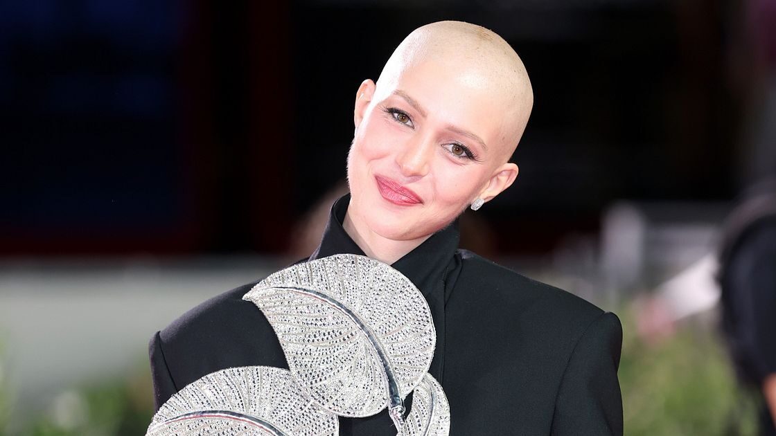 Natalia Paragoni sul red carpet di Venezia con la testa rasata dopo le cure